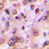 Anti-GSK3 beta (phospho Ser9) antibody used in IHC (Paraffin sections) (IHC-P). GTX55012
