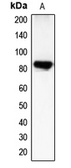 Anti-CHML antibody used in Western Blot (WB). GTX55138
