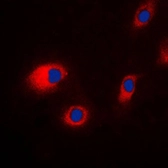 Anti-CLCN7 antibody used in Immunocytochemistry/ Immunofluorescence (ICC/IF). GTX55139