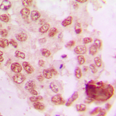 Anti-GRK5 antibody used in IHC (Paraffin sections) (IHC-P). GTX55150