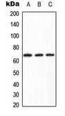 Anti-PPP2R1B antibody used in Western Blot (WB). GTX55165