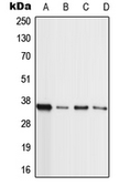 Anti-MLL4 antibody used in Western Blot (WB). GTX55187