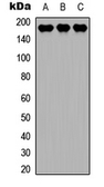 Anti-MEKK4 antibody used in Western Blot (WB). GTX55270