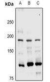 Anti-UBR1 antibody used in Western Blot (WB). GTX55291