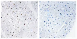 Anti-BLM (phospho Thr99) antibody used in IHC (Paraffin sections) (IHC-P). GTX55314