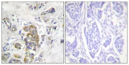 Anti-Integrin beta 4 (phospho Tyr1510) antibody used in IHC (Paraffin sections) (IHC-P). GTX55321