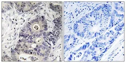 Anti-iNOS (phospho Tyr151) antibody used in IHC (Paraffin sections) (IHC-P). GTX55338