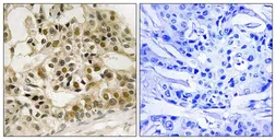 Anti-c-Myb (phospho Ser532) antibody used in IHC (Paraffin sections) (IHC-P). GTX55447