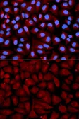 Anti-Antithrombin III antibody used in Immunocytochemistry/ Immunofluorescence (ICC/IF). GTX55514
