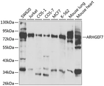 Anti-ARHGEF7 antibody used in Western Blot (WB). GTX55517