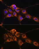 Anti-C1 inhibitor antibody used in Immunocytochemistry/ Immunofluorescence (ICC/IF). GTX55542