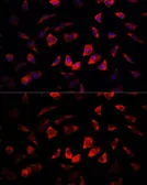 Anti-IGFBP4 antibody used in Immunocytochemistry/ Immunofluorescence (ICC/IF). GTX55672