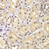 Anti-KPNA6 antibody used in IHC (Paraffin sections) (IHC-P). GTX55687