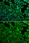 Anti-NDRG1 antibody used in Immunocytochemistry/ Immunofluorescence (ICC/IF). GTX55721