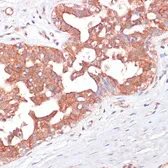 Anti-PGD antibody used in IHC (Paraffin sections) (IHC-P). GTX55744