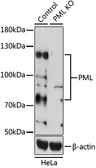 Anti-PML antibody used in Western Blot (WB). GTX55751