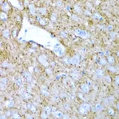 Anti-PTGDS antibody used in IHC (Paraffin sections) (IHC-P). GTX55765