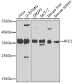 Anti-RFC5 antibody used in Western Blot (WB). GTX55780