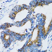 Anti-SIAH1 antibody used in IHC (Paraffin sections) (IHC-P). GTX55799