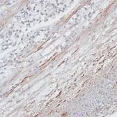 Anti-Tropomyosin 1 antibody used in IHC (Paraffin sections) (IHC-P). GTX55822
