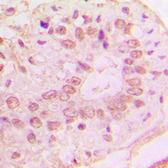 Anti-p15 INK4b antibody used in IHC (Paraffin sections) (IHC-P). GTX55855