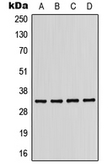 Anti-KIR2DL2 antibody used in Western Blot (WB). GTX55865