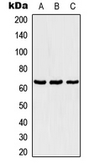 Anti-TBX18 antibody used in Western Blot (WB). GTX55909