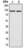 Anti-ARHGEF1 antibody used in Western Blot (WB). GTX55910