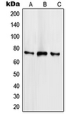 Anti-SCML2 antibody used in Western Blot (WB). GTX55921
