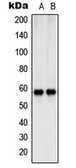 Anti-SHC2 antibody used in Western Blot (WB). GTX55939
