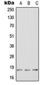 Anti-HES2 antibody used in Western Blot (WB). GTX55959