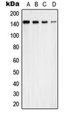 Anti-USP42 antibody used in Western Blot (WB). GTX55977