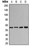 Anti-AChR alpha 1 antibody used in Western Blot (WB). GTX56028