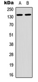 Anti-ARHGAP20 antibody used in Western Blot (WB). GTX56045