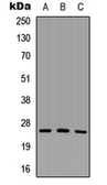 Anti-SCNM1 antibody used in Western Blot (WB). GTX56073