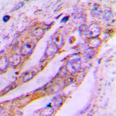 Anti-ATP5J2 antibody used in IHC (Paraffin sections) (IHC-P). GTX56084