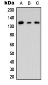 Anti-CNK2 antibody used in Western Blot (WB). GTX56090