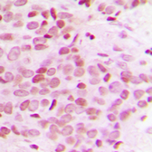 Anti-MED12 antibody used in IHC (Paraffin sections) (IHC-P). GTX56106