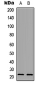 Anti-PXMP2 antibody used in Western Blot (WB). GTX56115