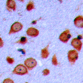 Anti-LMTK3 antibody used in IHC (Paraffin sections) (IHC-P). GTX56134