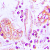 Anti-OTUB2 antibody used in IHC (Paraffin sections) (IHC-P). GTX56189