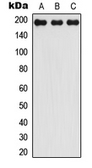 Anti-LMO7 antibody used in Western Blot (WB). GTX56232