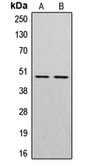 Anti-Cathepsin E antibody used in Western Blot (WB). GTX56272