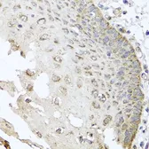 Anti-IRS2 antibody used in IHC (Paraffin sections) (IHC-P). GTX57160