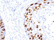 Anti-Ki67 antibody [IHC067] used in IHC (Paraffin sections) (IHC-P). GTX57186