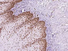 Anti-MLH1 antibody [IHC409] used in IHC (Paraffin sections) (IHC-P). GTX57187