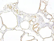 Anti-Tau antibody [IHC696] used in IHC (Paraffin sections) (IHC-P). GTX57199