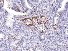 Anti-Mucin 5AC antibody [IHC625] used in IHC (Paraffin sections) (IHC-P). GTX57205