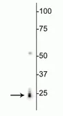 Anti-RBPMS antibody used in Western Blot (WB). GTX57225
