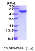 Mouse Aminoacylase 1 protein, His tag. GTX57287-pro
